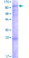 12.5% SDS-PAGE Stained with Coomassie Blue.